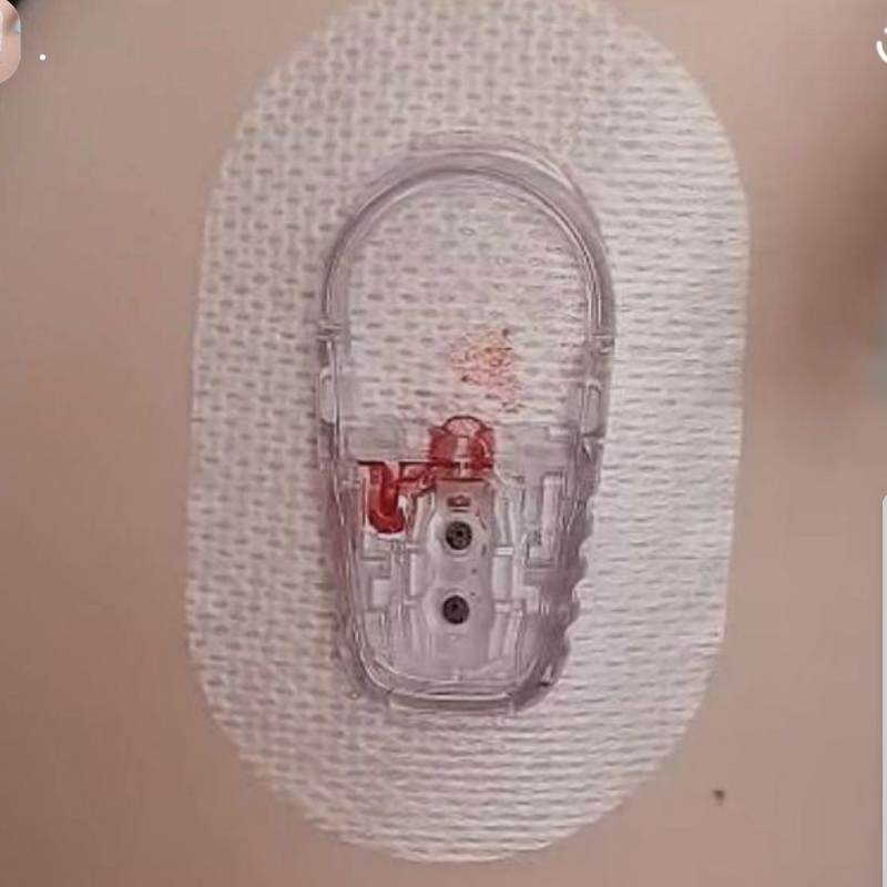 .